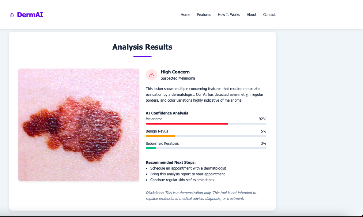 Skin Cancer Detection Thumbnail